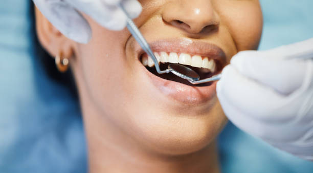 Best Emergency Dental Care for Abscessed Tooth in Algona, WA